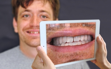 Szebb fogak a kiterjesztett valóságnak köszönhetően (videó)